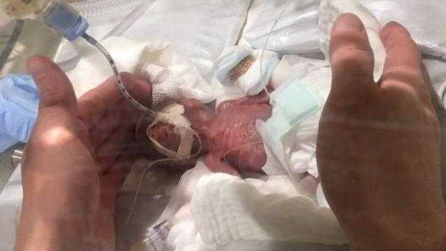 ولادة أصغر طفل رضيع في اليابان