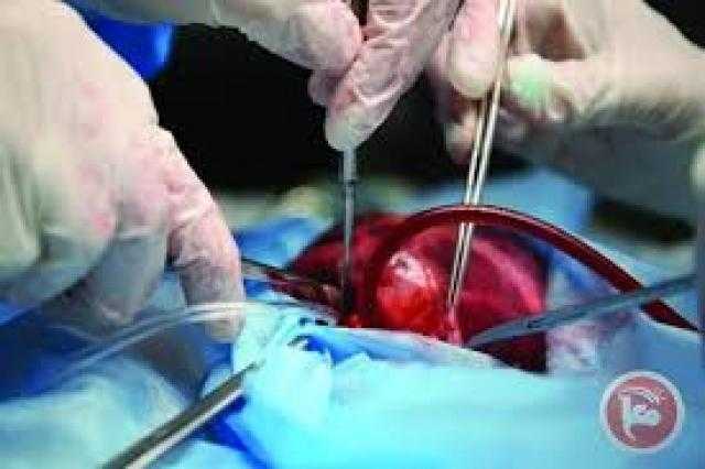 للمرة الأولى من نوعها عملية لإصلاح العمود الفقري لجنين في رحم أمه