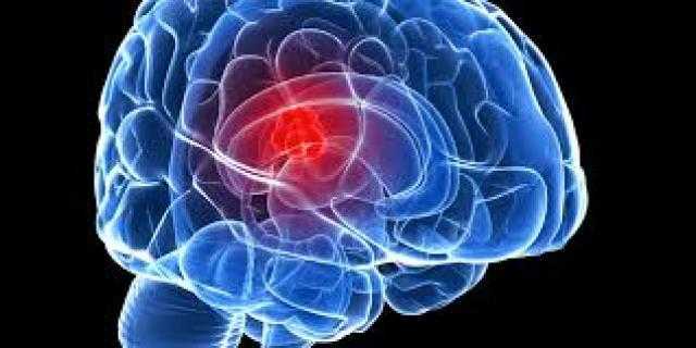 علامات تدل على إصابتك بورم فى المخ