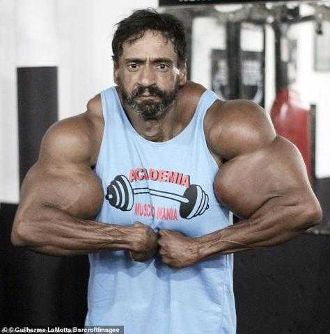 عايز 23 بوصة زيادة.. لاعب كمال أجسام يخاطر بحياته لتضخيم عضلاته