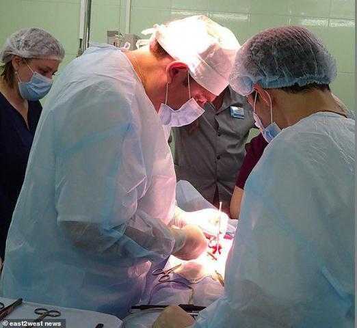 ببراعة شديدة.. أطباء روس يزيلون كتلة شعر ضخمة من داخل معدة فتاة