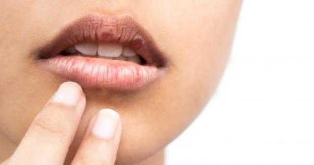 الهرمونات والقهوة والأدوية أبرز أسباب جفاف الفم