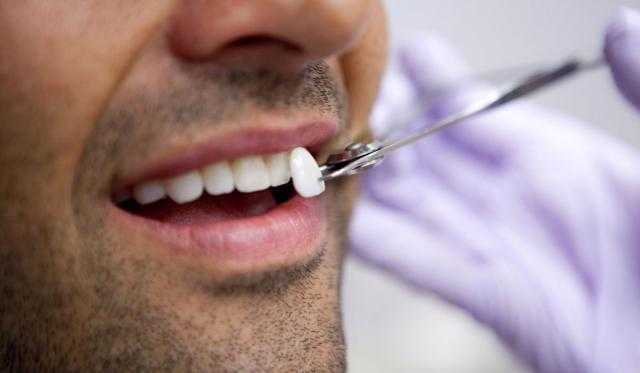 كل ما تريد معرفته عن «عدسات الأسنان»