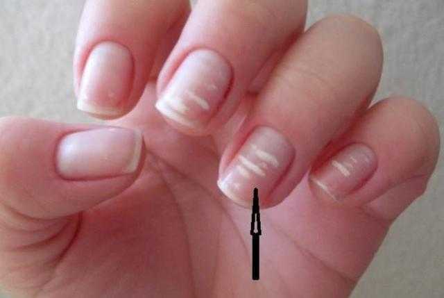 10 علامات على أظافرك تدل على مدى صحتك
