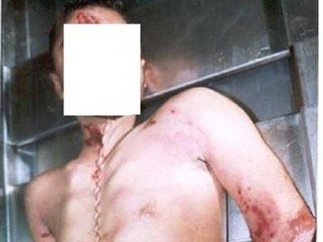 مبلط سيراميك يمزيق جسد عامل بآلة حادة بشبين القناطر