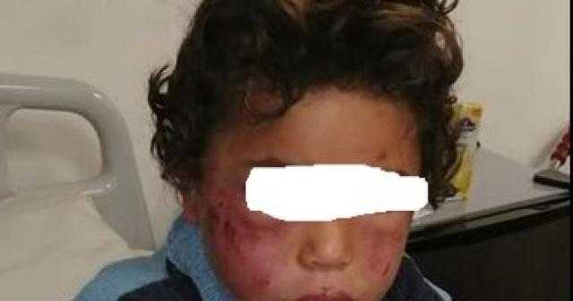 ”كنت بضربها بسلك كهرباء عشان بتلعب فى الشارع”.. اعترافات الأب المتهم بتعذيب طفلته