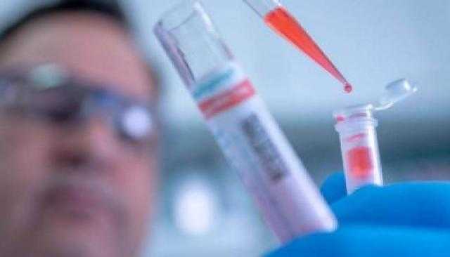 شركة ألمانية ترفض بيع مليار زجاجه لتعبئة لقاح كورونا لحين الانتهاء من التجارب