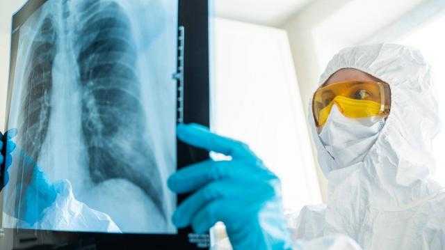 مؤسسات طبية تعمل على تطوير لقاح كورونا تتعرص لهجمات إلكترونية روسية