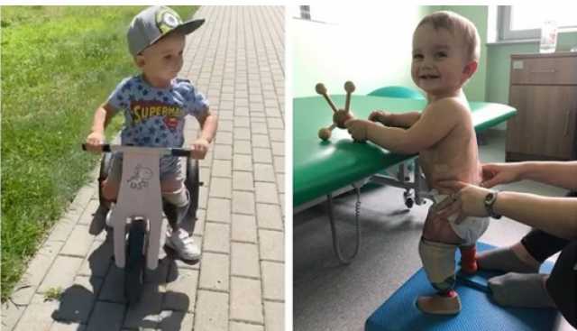 رغم بتر ساقيه.. طفل عمره عامين يقود الدراجة لأول مرة.. شاهد رد فعله