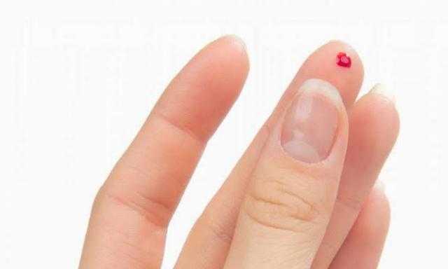 عمره 9 سنوات.. صبي تجاهل وخزة إبرة فتسببت له في مرض خطير