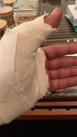 إصابة أحمد العوضي أثناء تصوير مسلسل «اللي ملوش كبير»