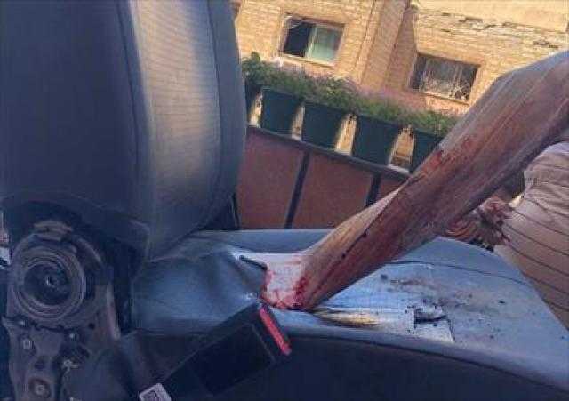 قطعة حديد تخترق جسم سائق ويدخل العمليات بكرسي السيارة