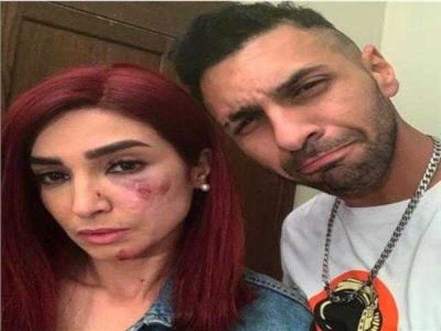 روجينا تبرئ مخرج «بنت السلطان» من الإصابات التي تعرضت لها أثناء التصوير