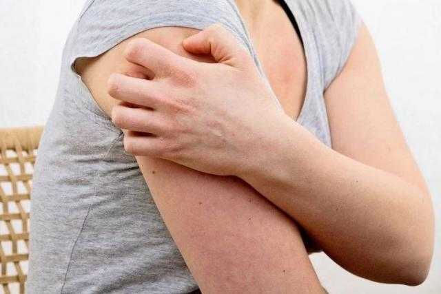 ماذا تعرف عن التهاب العضلات والجلد؟.. مرض مناعي