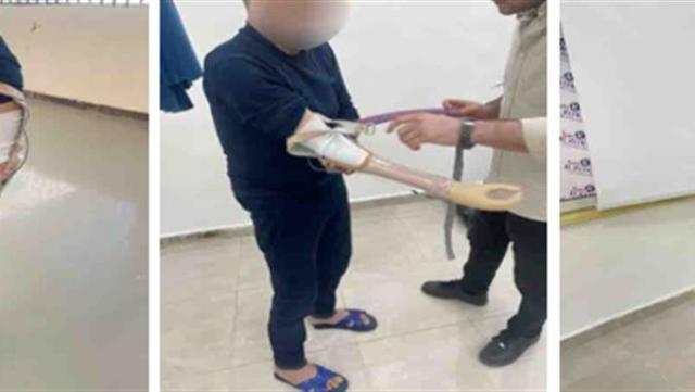 الداخلية توفر أطرافًا صناعية لعدد من النزلاء بمراكز إصلاح وتأهيل بدر