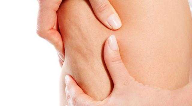 وداعا للسيوليت.. نص ساعة رياضة يوميا بتمارين محددة وانسي المشكلة