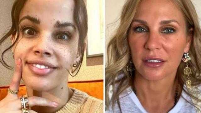 موعد حفل زفاف نور عمرو دياب.. شيرين رضا تكشف التفاصيل
