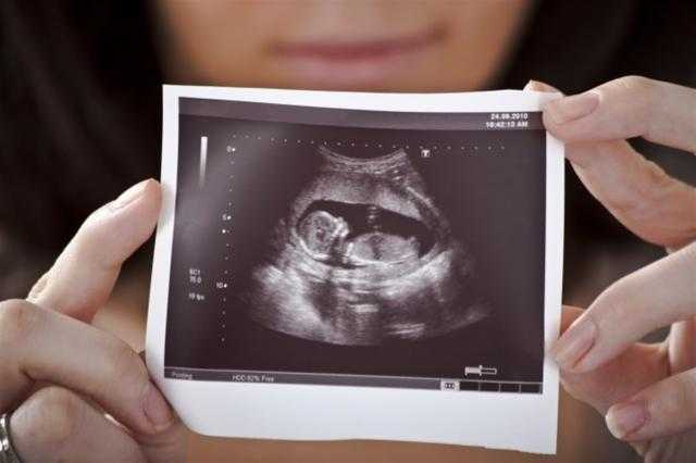 بنتيجة مؤكدة.. تعرفي على كيفية إجراء اختبار الحمل المنزلي باستخدام ”الملح”