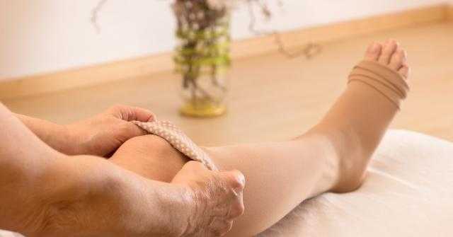 نصائح لمنع ظهور الدوالى بالساق