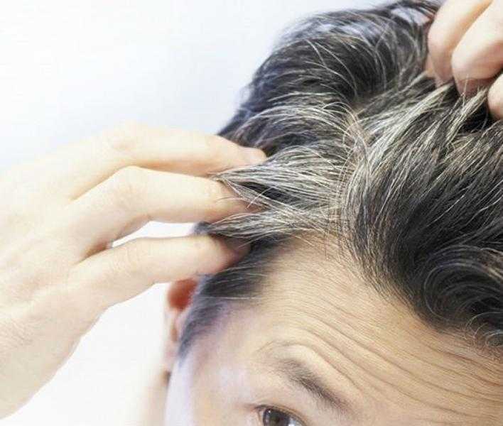 عادات خاطئة تسرع من ظهور الشعر الأبيض