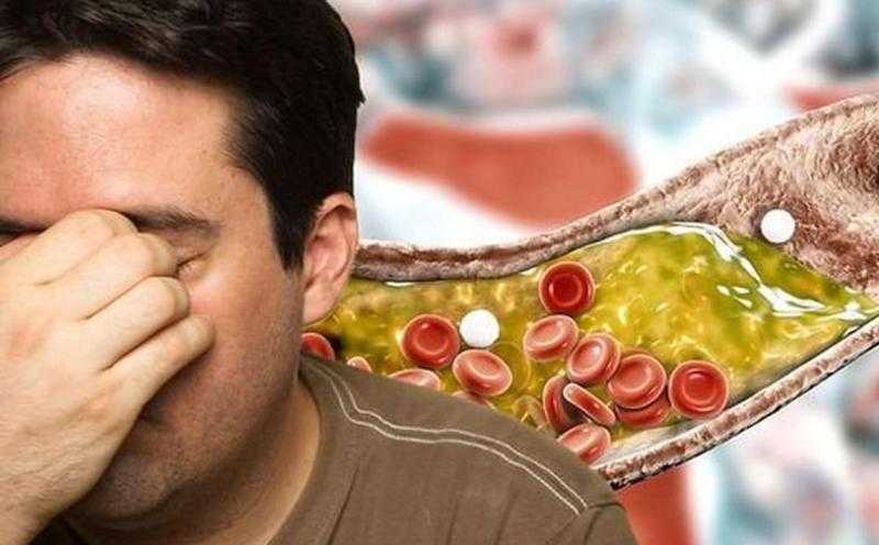 هل يمكن لأصحاب الكوليسترول المرتفع تناول اللحم الأحمر؟