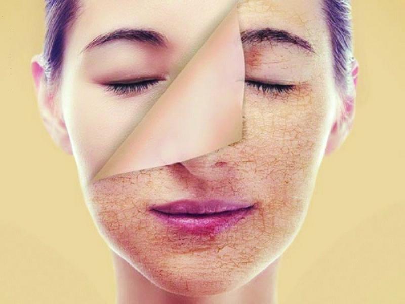 كيف تعتنى بصحة جلدك ؟ إليك 13 نصيحة هامة