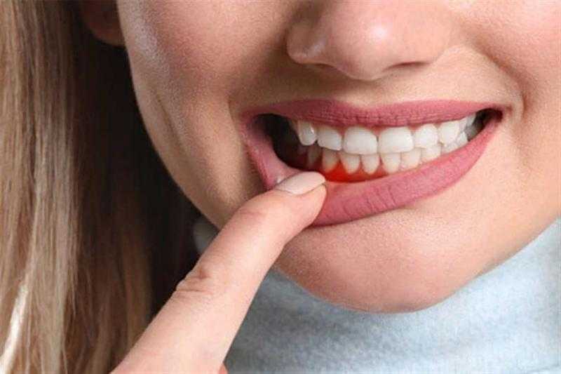 تعرف على أبرز مسببات آلام اللثة وطرق الوقاية منها