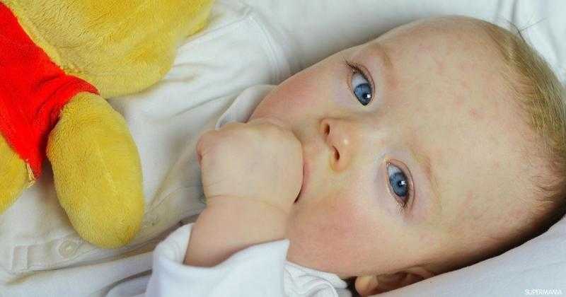 تعرف على أعراض حساسية الحليب وطرق الوقاية