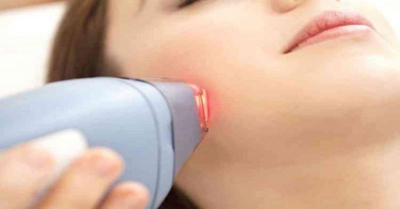 تعرف على أفضل طرق إزالة شعر الوجه الحساس