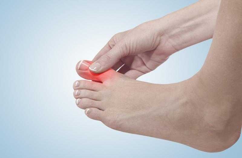 يُسبب مرض خطير.. حسام موافي يحذر من النقرس