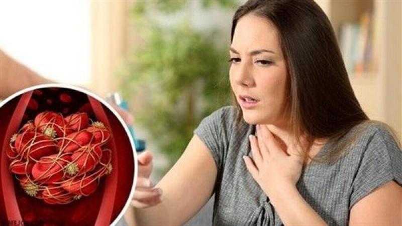 سبب صادم وراء الوفاة المفاجئة.. طبيبة تكشف التفاصيل