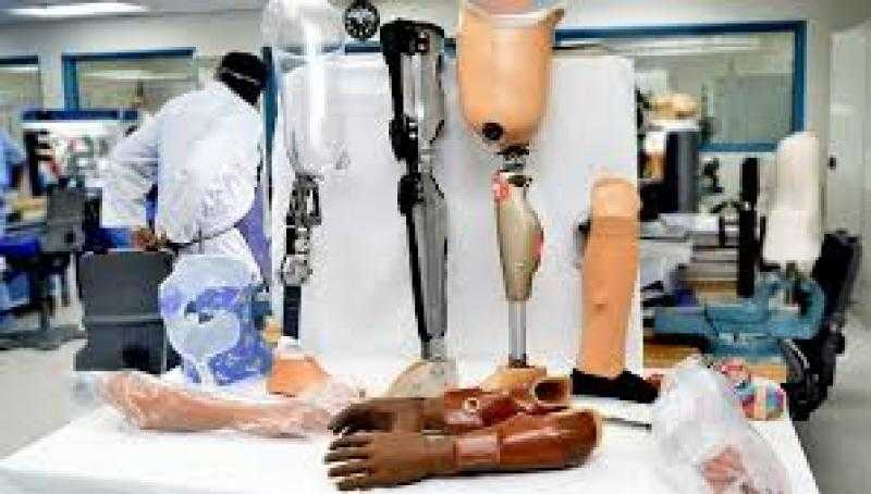 تجهيز مراكز التجميع ضمن مشروع توطين صناعة الأطراف الصناعية بـ6 محافظات