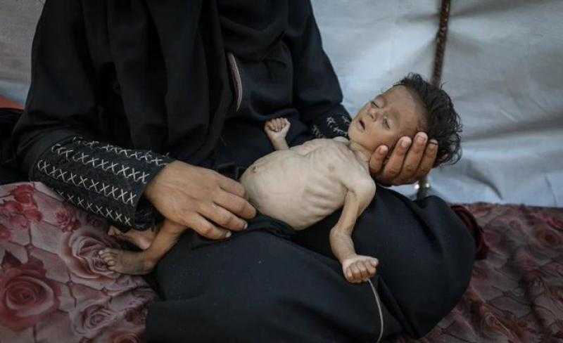 شهداء الجوع في غزة.. ارتفاع ضحايا المجاعة وسوء التغذية إلى 266 شهيدا