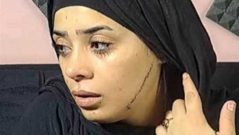 حجز المتهمة بتشويه وجه عروس طليقها في منطقة مصر القديمة للتحريات