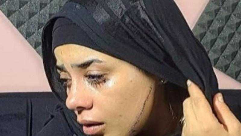 15 نوفمبر.. أولى جلسات محاكمة المتهمة بتشويه وجه عروس مصر القديمة