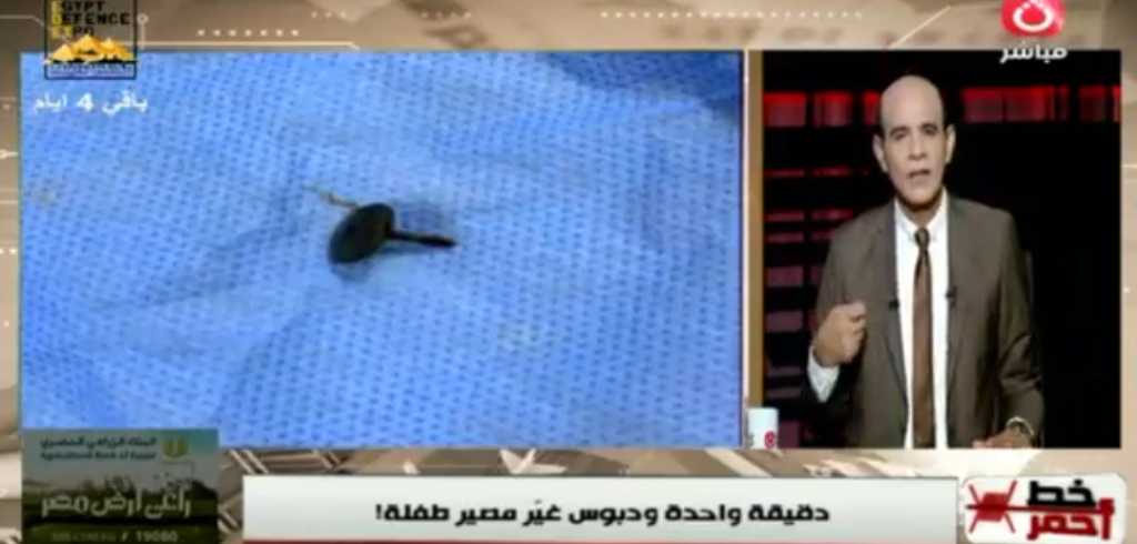 طفلة تنجو من خطر داهم| دبوس عالق في المريء منذ 6 أشهر.. شاهد ماذا حدث؟