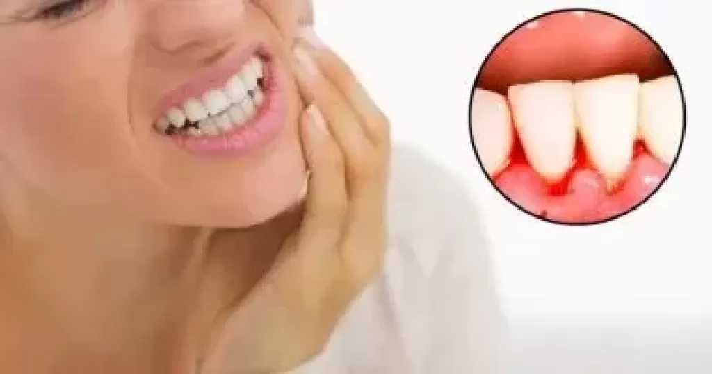 3 طرق لوقاية الفم واللثة من ارتفاع السكر التراكمى