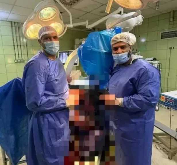 فريق جراحة العظام بمستشفى كفر الدوار العام يُنقذ ساق شاب ويُعيد وظيفتها التشريحية بعد كسر قديم معقد