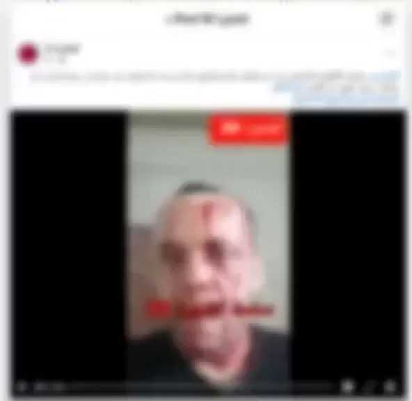 ضبط متهم بإصابة شخص بجرح قطعي في رأسه لخلافات مالية بالقاهرة