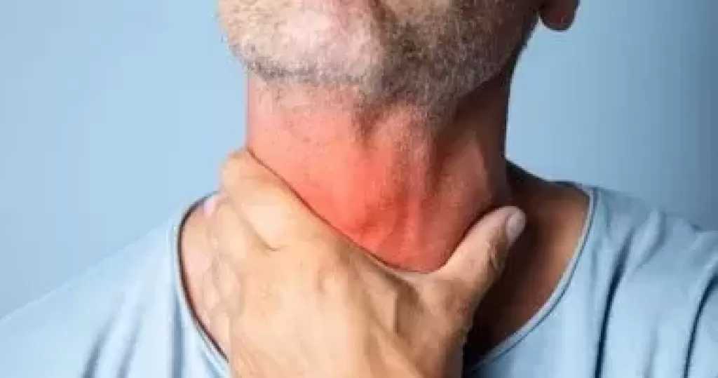 التهاب الحلق المتكرر.. قد لا يكون دائمًا مجرد عدوى