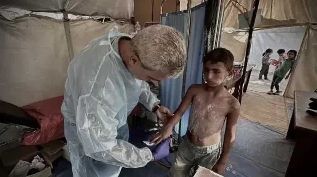 أونروا: 125 ألف إصابة بالتهابات جلدية في غزة بين يناير ومايو
