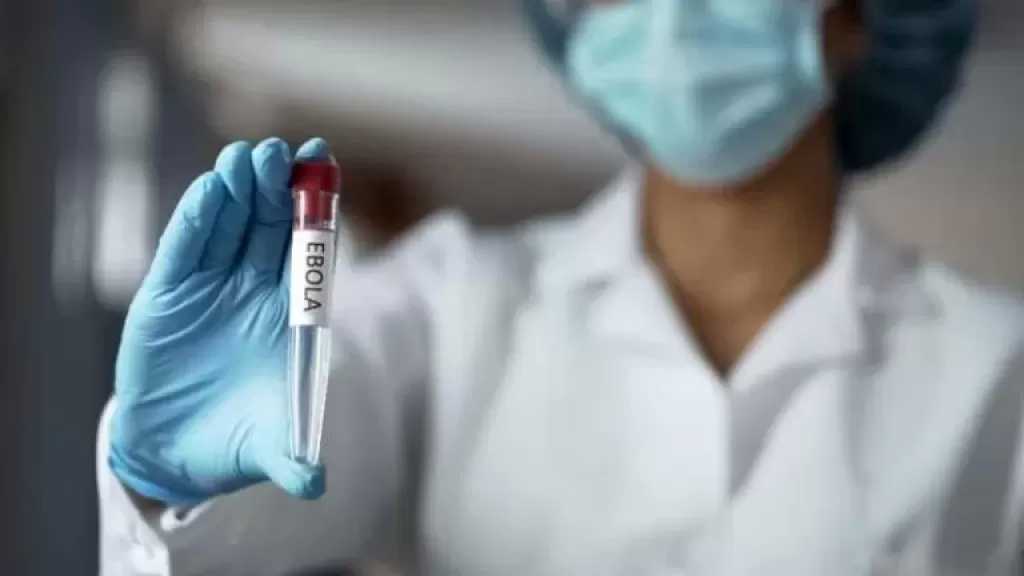 أستاذ أمراض صدرية يبعث برسالة طمأنة: إيبولا تحت السيطرة عالميًا ولا ينتشر بنفس سرعة كورونا