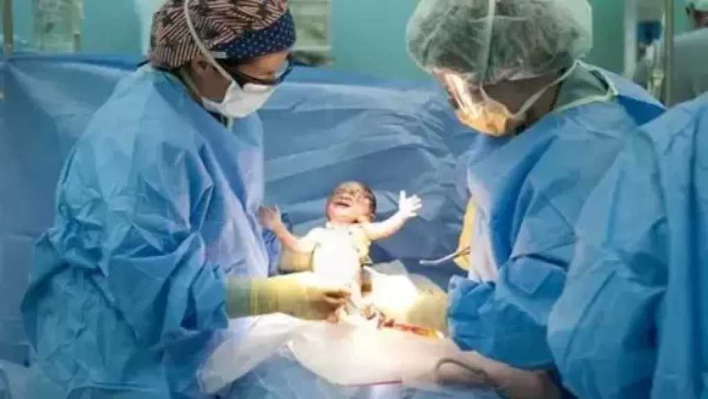 نائب وزير الصحة تناقش آليات خفض معدلات الولادة القيصرية غير المبررة طبيا