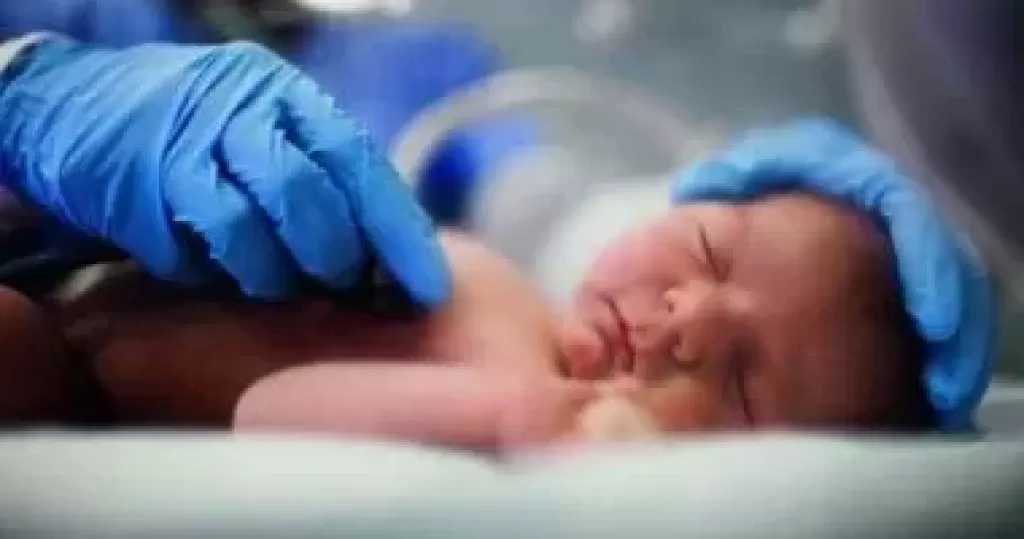 الحكومة: الولاده القيصرية عند الضرورة وإلزام المستشفيات بتقارير عن معدلاتها